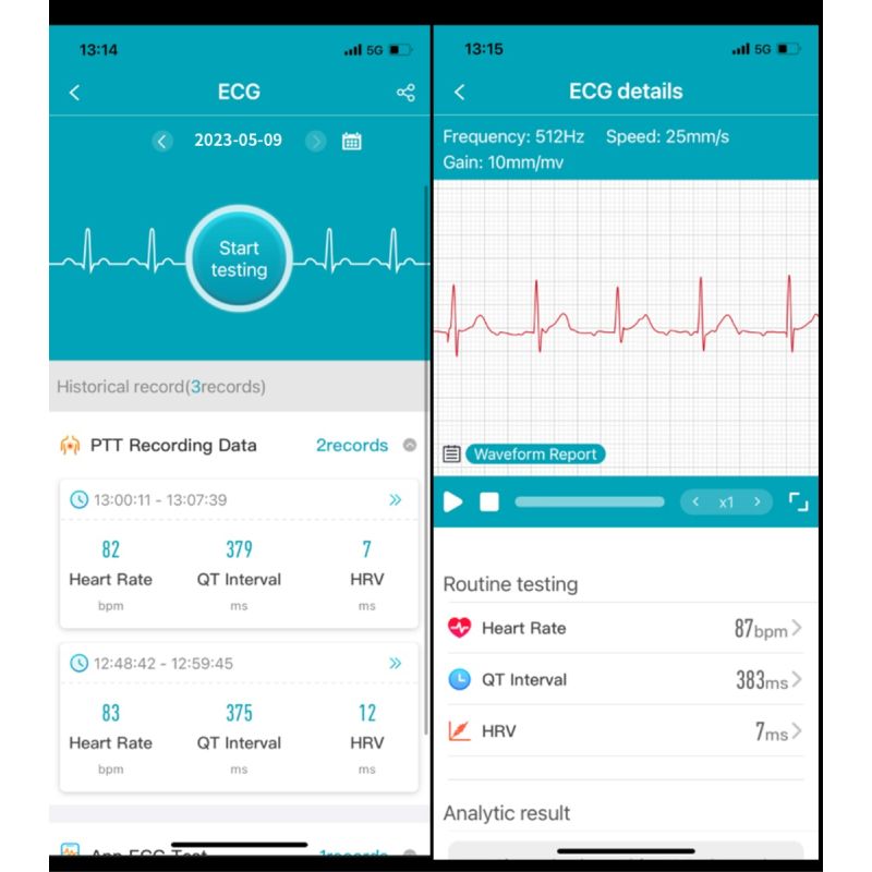 Smartwatch ET540 Monitoreo de Salud, Reloj Inteligente con Oxímetro, Glucosa, ECG, Presión Arterial, Fitness Tracke