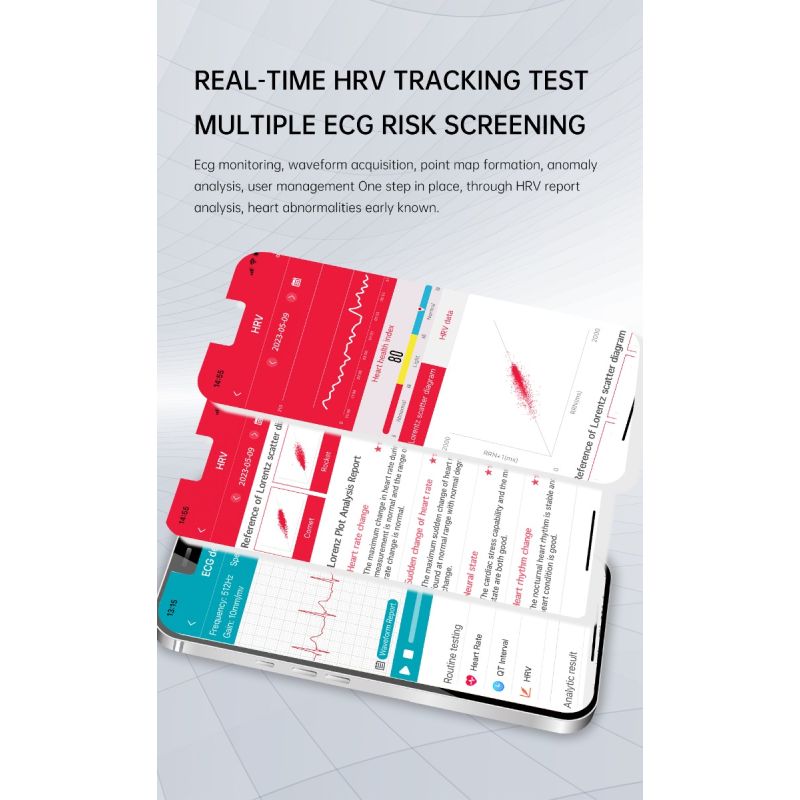 Smartwatch ET540 Monitoreo de Salud, Reloj Inteligente con Oxímetro, Glucosa, ECG, Presión Arterial, Fitness Tracke