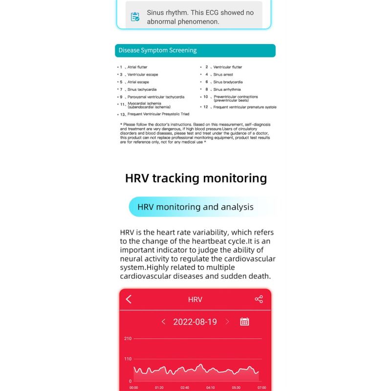 EP01 Reloj Inteligente Salud: ECG, PPG, HRV, Glucosa en Sangre, Temperatura. Rastreador Fitness 1.47
