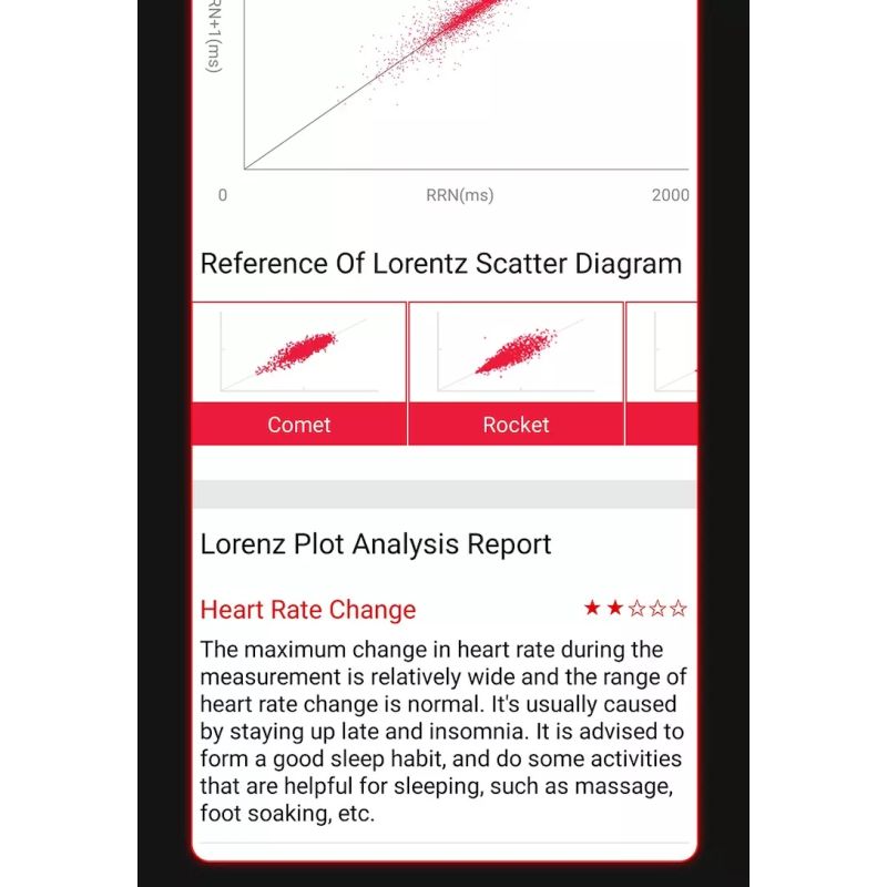 EP02 Smartwatch ECG Glucosa Sangre Temperatura HR, Fitness Tracker 1.57