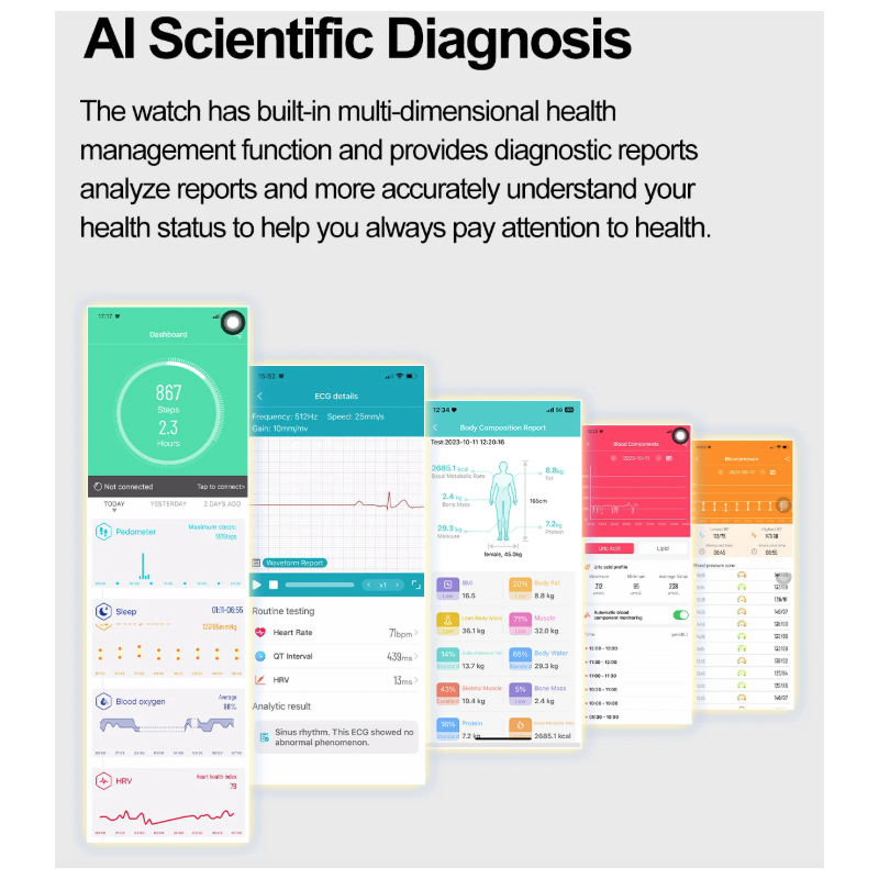 E580 Smartwatch: Glucosa, ECG, Frecuencia Cardíaca, Presión Arterial, IP68. Monitorización Salud 368*448