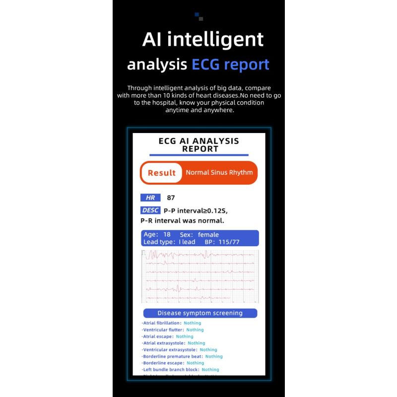 Reloj Inteligente W11 1.32