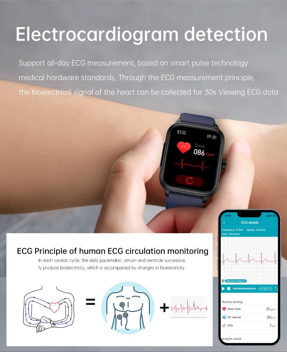 ET540 Glucosa en sangre ECG Temperatura corporal Presión arterial Oxígeno en sangre Frecuencia cardíaca Llamada Bluetooth Reloj inteligente Rastreador de fitness