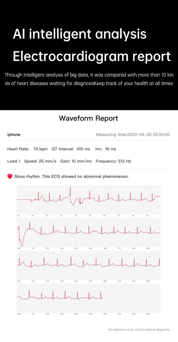 ET540 Glucosa en sangre ECG Temperatura corporal Presión arterial Oxígeno en sangre Frecuencia cardíaca Llamada Bluetooth Reloj inteligente Rastreador de fitness