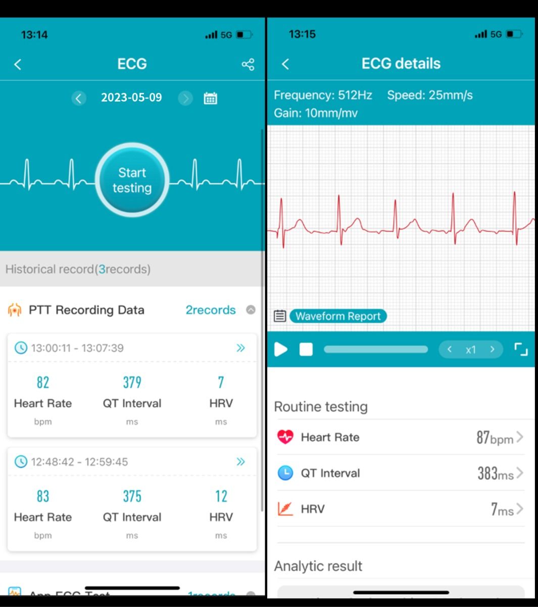 ET540 Glucosa en sangre ECG Temperatura corporal Presión arterial Oxígeno en sangre Frecuencia cardíaca Llamada Bluetooth Reloj inteligente Rastreador de fitness