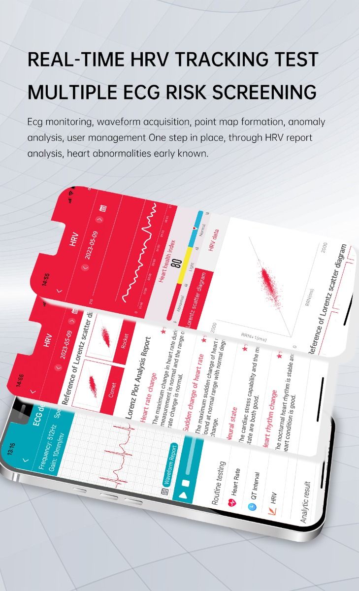 ET540 Glucosa en sangre ECG Temperatura corporal Presión arterial Oxígeno en sangre Frecuencia cardíaca Llamada Bluetooth Reloj inteligente Rastreador de fitness
